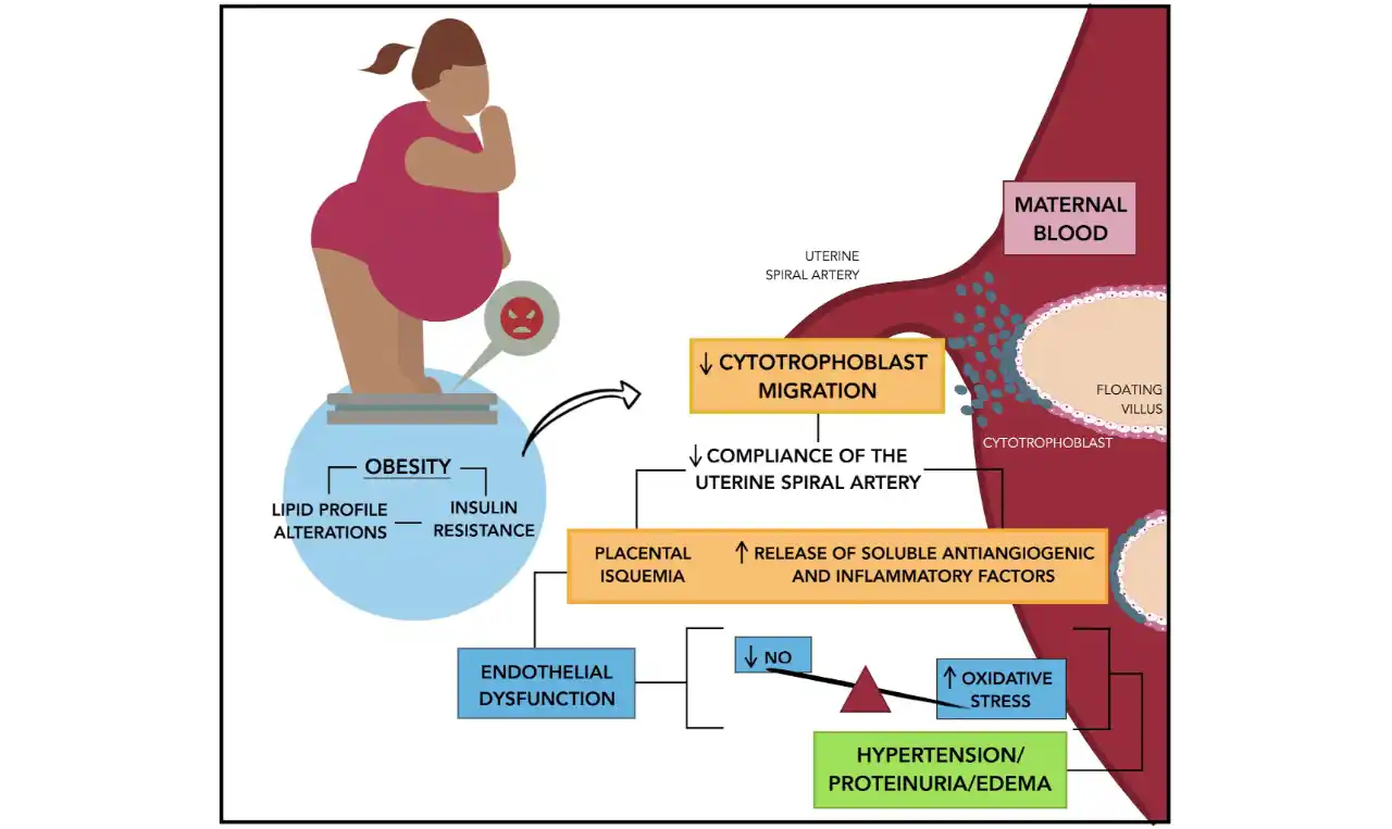 Eclampsia Symptoms, Causes , Diagnosis and Unknown Facts