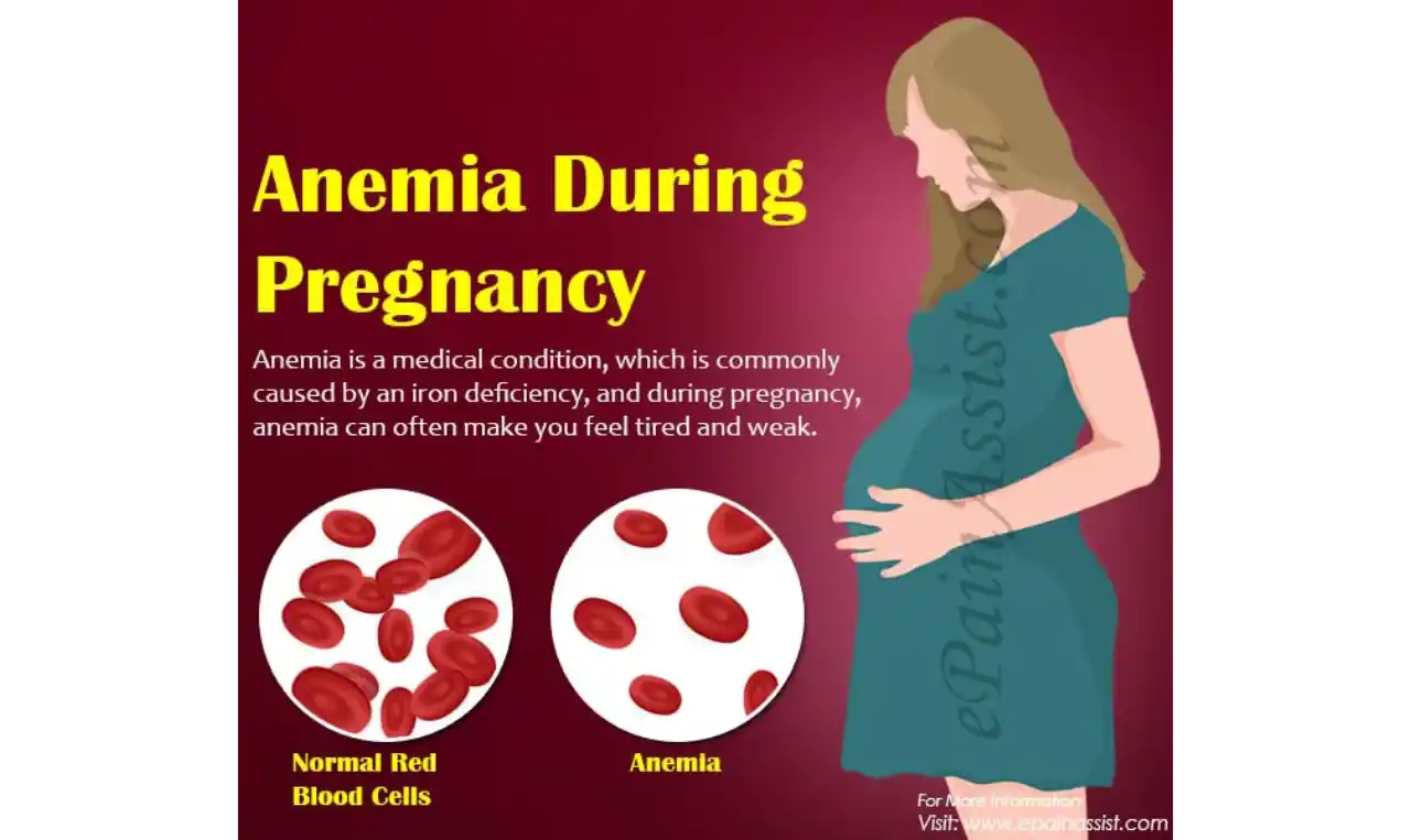 Anaemia during pregnancy (Maternal anemia)   Symptoms, Causes , Diagnosis and Unknown Facts