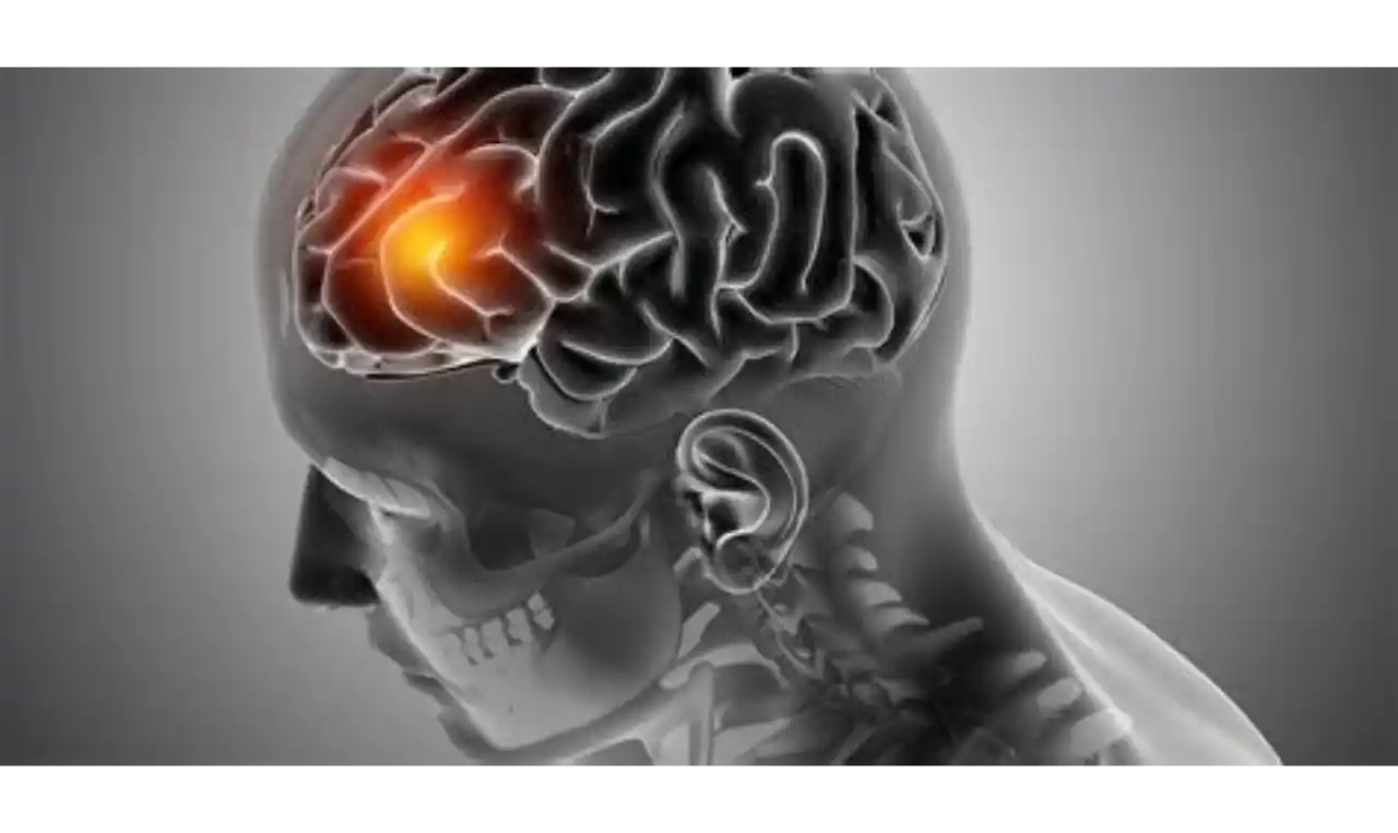 Brain Tumour   Symptoms, Causes , Diagnosis and Unknown Facts