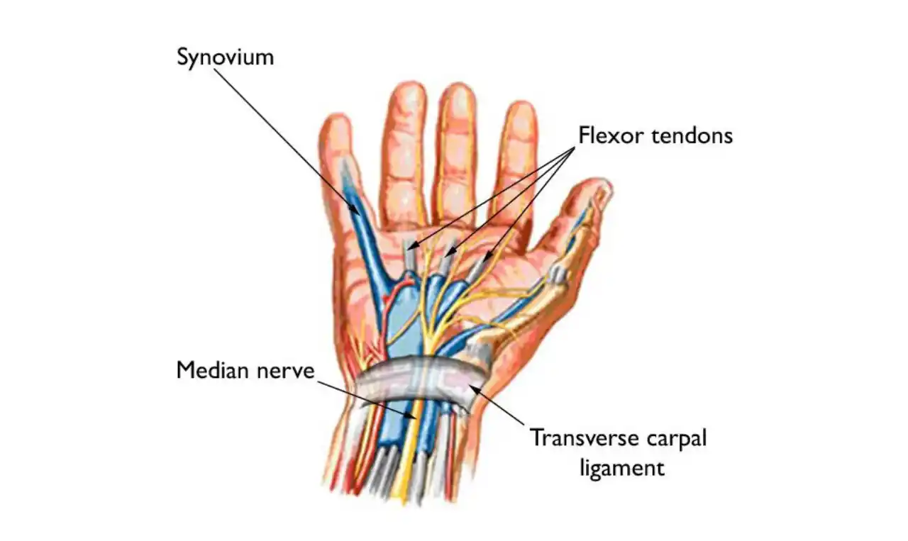 Carpal Tunnel Syndrome   Symptoms, Causes , Diagnosis and Unknown Facts