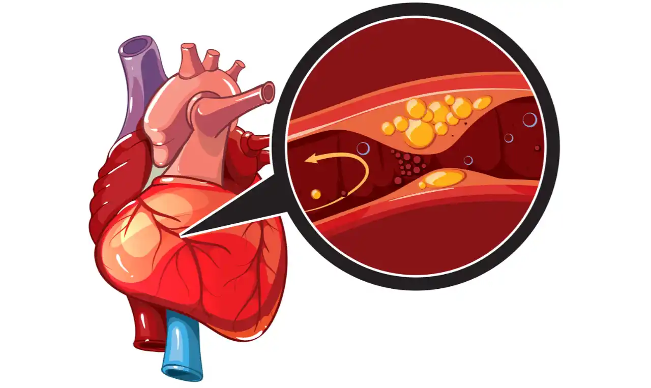 Coronary Heart Disease   Symptoms, Causes , Diagnosis and Unknown Facts