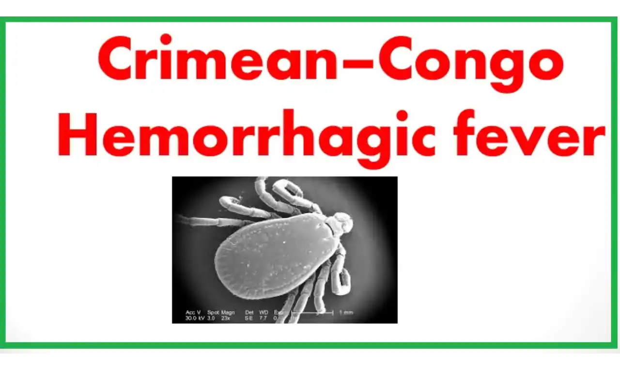 Crimean-Congo haemorrhagic fever  Symptoms, Causes , Diagnosis and Unknown Facts