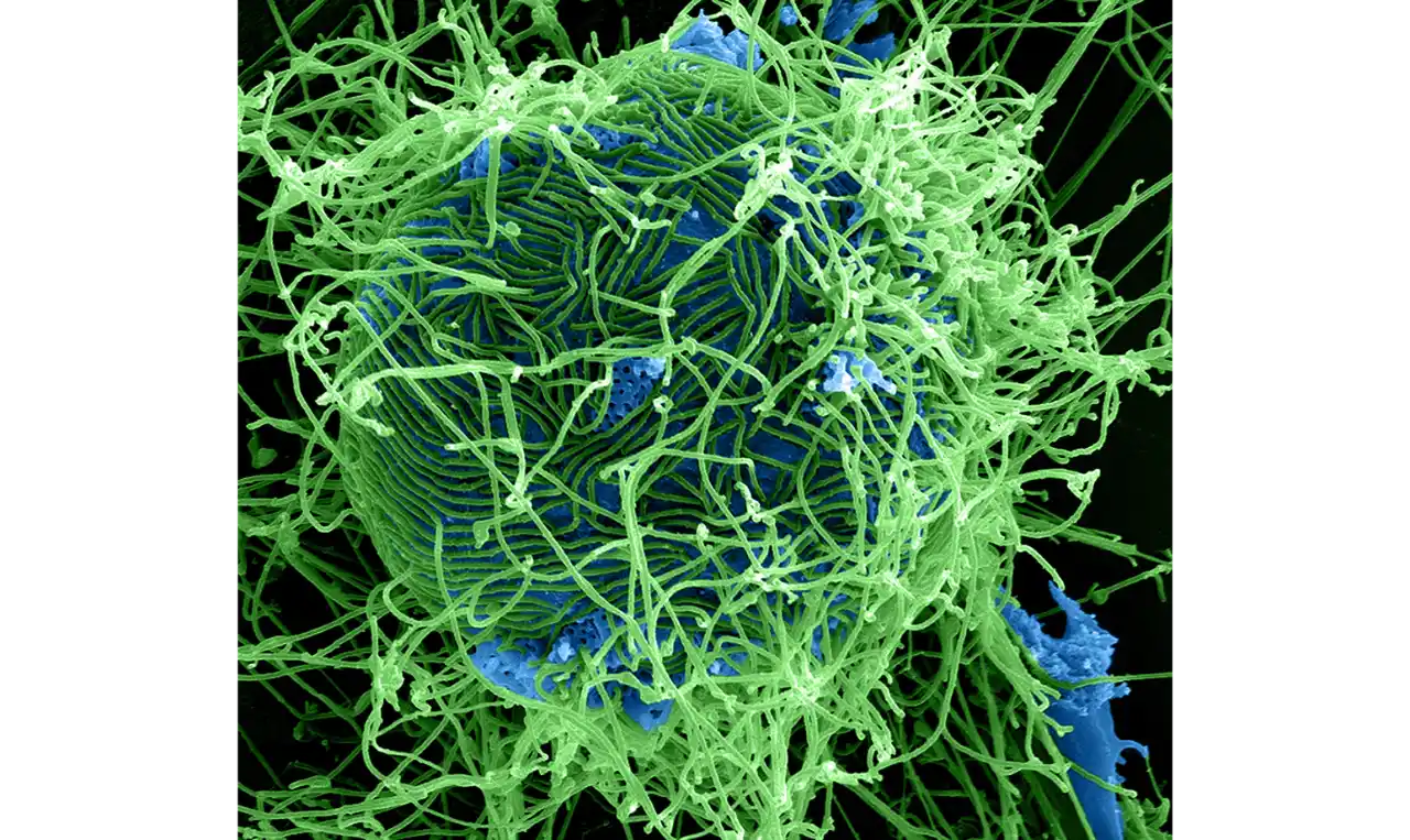 Ebola Virus Disease  Symptoms, Causes , Diagnosis and Unknown Facts