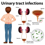 Unveiling the Hidden Dangers: Common Urinary Infection Symptoms Explained